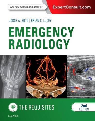 Бумажная книга «Emergency Radiology: The Requisites», авторов Брайан К Люси, Хорхе А. Сото - фото №1