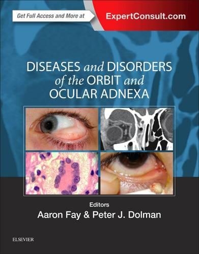 Бумажная книга «Diseases and Disorders of the Orbit and Ocular Adnexa», авторов Аарон Фэй, Питер Дж. Долман - фото №1