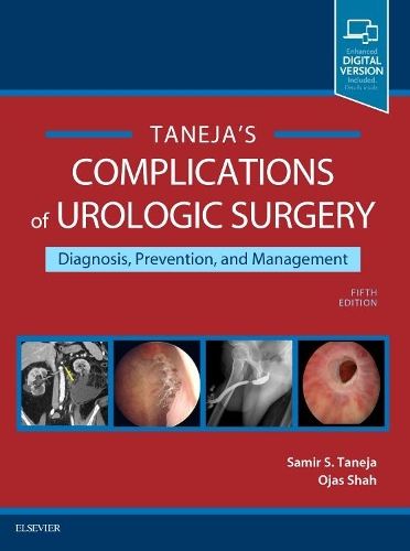 [object Object] «Complications of Urologic Surgery: Prevention and Management», авторов Оджас Шах, Самир С. Танеджа - фото №1
