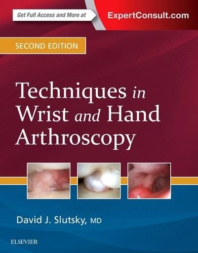 Бумажная книга «Techniques in Wrist and Hand Arthroscopy», автор Дэвид Дж. Слуцкий - фото №1