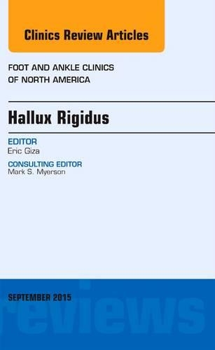Бумажная книга «Hallux Rigidus, An issue of Foot and Ankle Clinics of North America», автор Эрик Гиза - фото №1