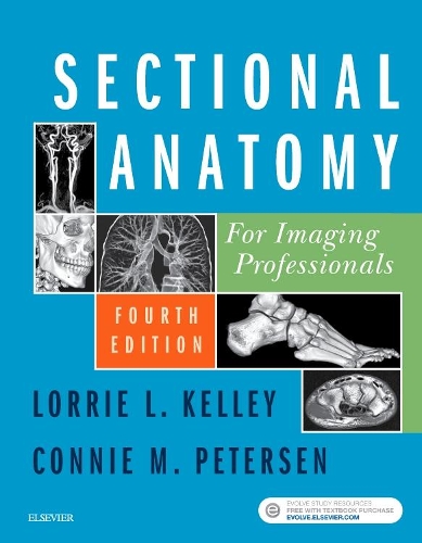 Бумажная книга «Sectional Anatomy for Imaging Professionals», авторов Конни Петерсен, Лорри Л. Келли - фото №1
