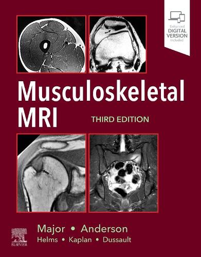 Бумажная книга «Musculoskeletal MRI», авторов Марк В. Андерсон, Нэнси М. Мейджор - фото №1