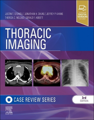 Паперова книга «Thoracic Imaging: Case Review», авторів Джеральд Ф. Ебботт, Джеффрі П. Канне, Джонатан Х. Чанг, Джастін Т. Стоуелл, Тереза К. Маклауд - фото №1