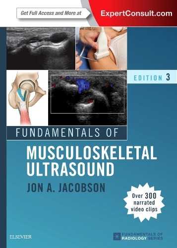 Бумажная книга «Fundamentals of Musculoskeletal Ultrasound», автор Джон А. Якобсон - фото №1