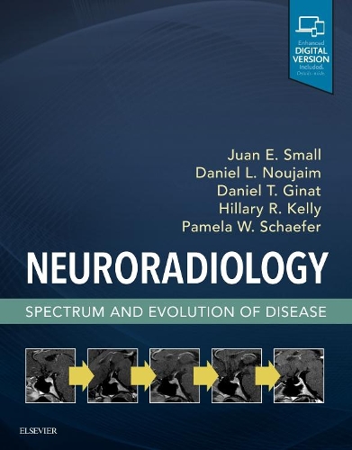 Паперова книга «Neuroradiology: Spectrum and Evolution of Disease», авторів Деніел Л. Нуджаїм, Даніель Т. Гінат, Гілларі Р. Келлі, Хуан Е. Смолл, Памела В. Шефер - фото №1