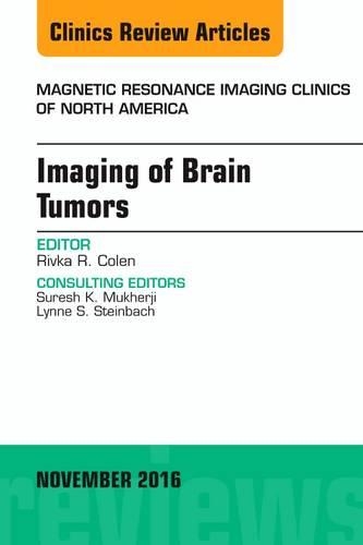 Паперова книга «Imaging of Brain Tumors, An Issue of Magnetic Resonance Imaging Clinics of North America», автор Рівка Р. Колен - фото №1