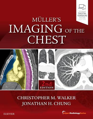 Бумажная книга «Muller's Imaging of the Chest: Expert Radiology Series», авторов Кристофер М. Уокер, Джонатан Х. Чанг - фото №1