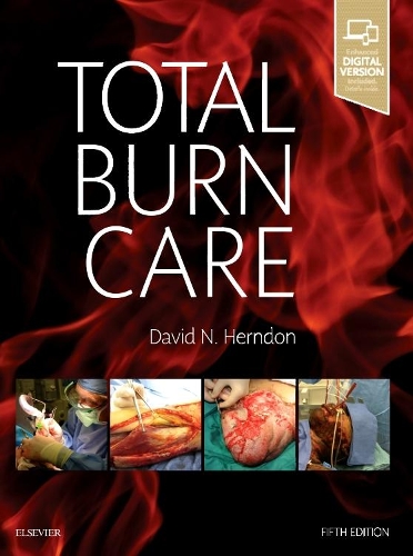Паперова книга «Total Burn Care», автор Девід Н. Герндон - фото №1