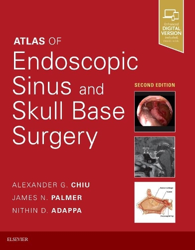 Бумажная книга «Atlas of Endoscopic Sinus and Skull Base Surgery», авторов Александр Г. Чиу, Джеймс Н. Палмер, Нитин Д Адаппа - фото №1