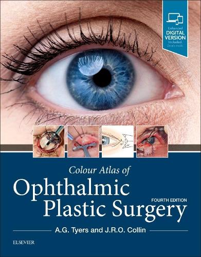 Бумажная книга «Colour Atlas of Ophthalmic Plastic Surgery», авторов Энтони Г. Тайерс, Дж. Р. О. Коллин - фото №1
