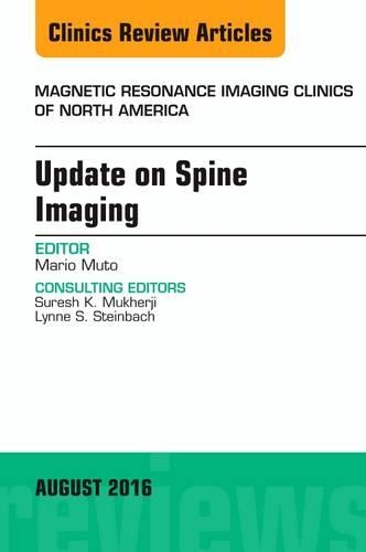 [object Object] «Update on Spine Imaging, An Issue of Magnetic Resonance Imaging Clinics of North America», автор Маріо Муто - фото №1