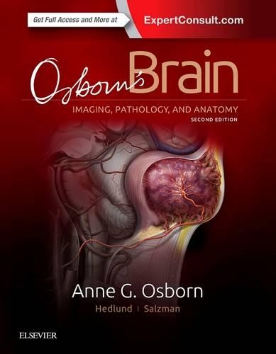 Бумажная книга «Osborn's Brain», авторов Энн Дж. Осборн, Гэри Л. Хедлунд, Карен Л. Зальцман - фото №1