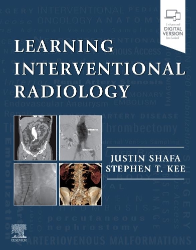 Паперова книга «Learning Interventional Radiology», авторів Джастін Шафа, Стівен Т. Кі - фото №1