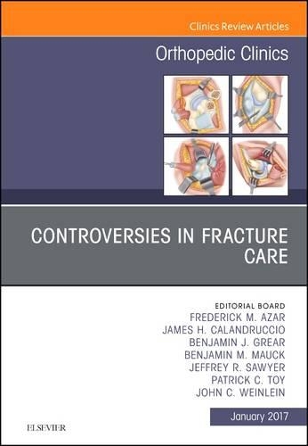 Бумажная книга «Controversies in Fracture Care, An Issue of Orthopedic Clinics», авторов Бенджамин Дж. Грир, Бенджамин М. Маук, Фредерик М. Азар, Джеймс Х. Каландруччо, Джеффри Р. Сойер, Джон К. Вейнлейн, Патрик К. Той - фото №1
