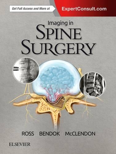 Паперова книга «Imaging in Spine Surgery», авторів Бернард Р. Бендок, Джамал МакКлендон-молодший, Джеффрі С. Росс - фото №1
