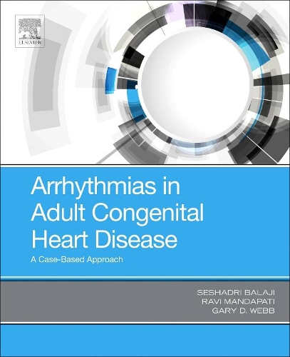 Паперова книга «Arrhythmias in Adult Congenital Heart Disease: A Case-Based Approach», авторів Гарі Вебб, Раві Мандапаті, Сешадрі Баладжі - фото №1