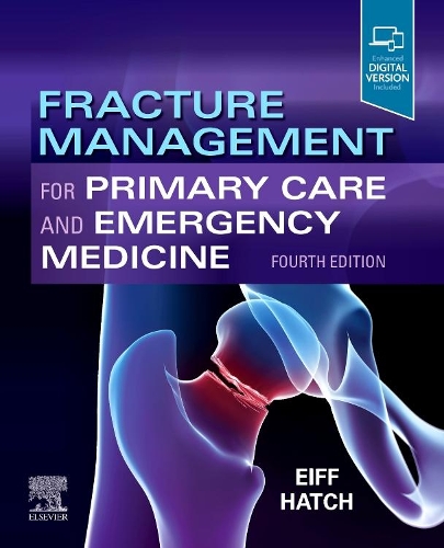 Бумажная книга «Fracture Management for Primary Care and Emergency Medicine», авторов М. Патрис Эйфф, Роберт Л. Хэтч - фото №1