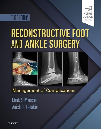 Бумажная книга «Reconstructive Foot and Ankle Surgery: Management of Complications», авторов Аниш Р. Кадакия, Марк С. Майерсон - фото №1