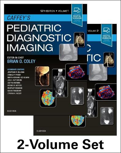 [object Object] «Caffey's Pediatric Diagnostic Imaging, 2-Volume Set», автор Брайан Д. Коули - фото №1