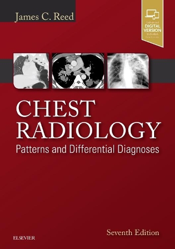 Бумажная книга «Chest Radiology: Patterns and Differential Diagnoses», автор Джеймс К. Рид - фото №1