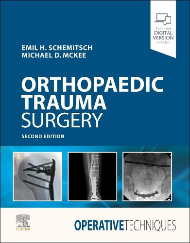 Бумажная книга «Operative Techniques: Orthopaedic Trauma Surgery», авторов Эмиль Шемич, Майкл Д. Макки - фото №1