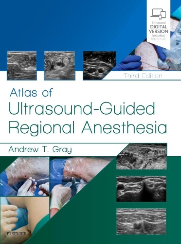 Бумажная книга «Atlas of Ultrasound-Guided Regional Anesthesia», автор Эндрю Т. Грей - фото №1