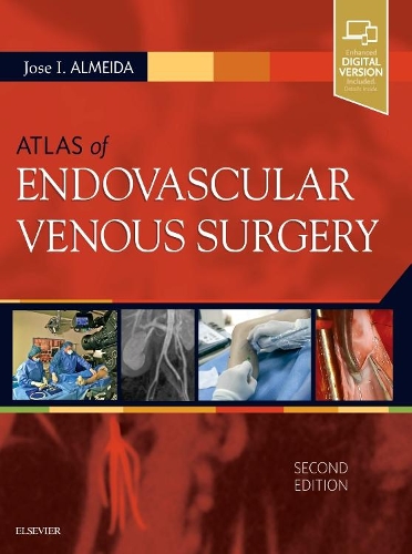 Бумажная книга «Atlas of Endovascular Venous Surgery», автор Хосе Алмейда - фото №1