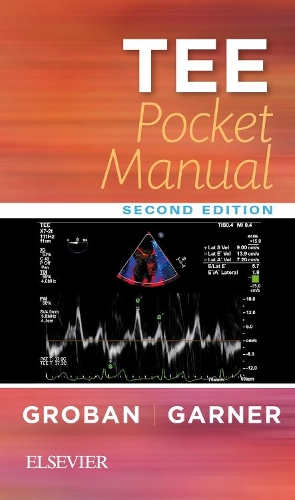 Паперова книга «TEE Pocket Manual», авторів Чандріка Раджан Гарнер, Ліанн Гробан - фото №1