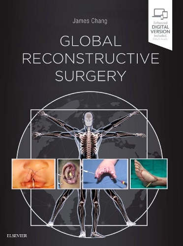Паперова книга «Global Reconstructive Surgery», автор Джеймс Чанг - фото №1