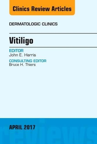Бумажная книга «Vitiligo, An Issue of Dermatologic Clinics», автор Джон Э. Харрис - фото №1