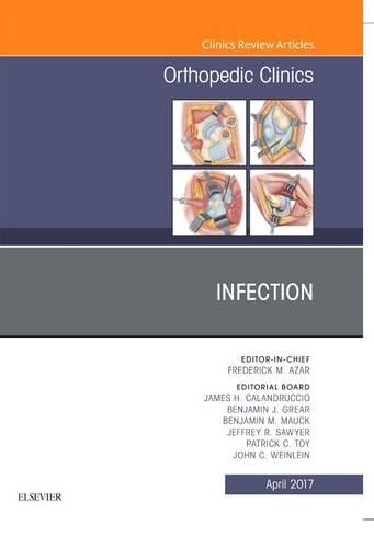 Паперова книга «Infection, An Issue of Orthopedic Clinics», авторів Бенджамін Дж. Грір, Бенджамін М. Маук, Джеймс Г. Каландруччо, Джеффрі Р. Сойєр, Джон К. Вайнлайн, Патрік К. Той - фото №1