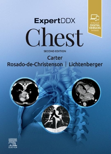 Паперова книга «ExpertDDx: Chest», авторів Бретт В. Картер, Джон П. Ліхтенбергер III, Мелісса Л. Росадо-де-Крістенсон, Сантьяго Мартінес-Хіменес - фото №1