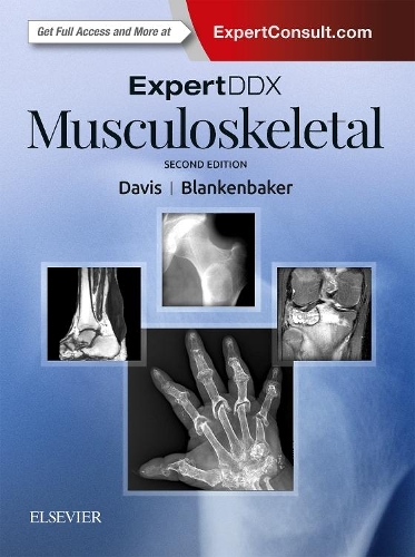 Паперова книга «ExpertDDx: Musculoskeletal», авторів Донна Г. Бланкенбейкер, Кіркленд В. Девіс - фото №1