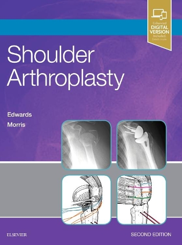Бумажная книга «Shoulder Arthroplasty», авторов Брент Дж. Моррис, Т. Брэдли Эдвардс - фото №1