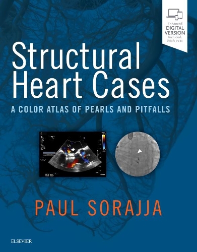 Бумажная книга «Structural Heart Cases: A Color Atlas of Pearls and Pitfalls», авторов Эммануил Брилакис, Джон Р. Лессер, Пол Сораджа, Ричард Баэ, Уэсли А Педерсен - фото №1