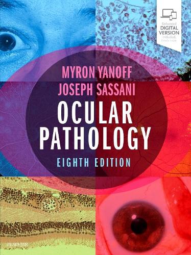 Бумажная книга «Ocular Pathology», авторов Джозеф В. Сассани, Мирон Янофф - фото №1