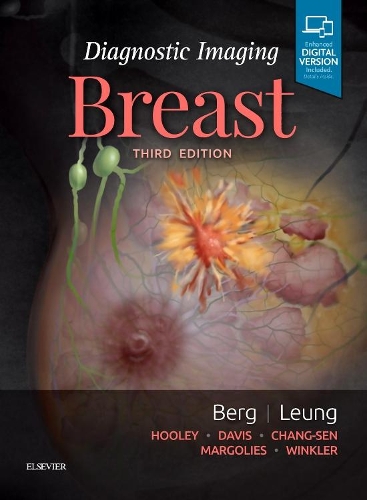 Паперова книга «Diagnostic Imaging: Breast», авторів Джессіка Люн, Венді А. Берг - фото №1
