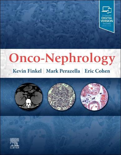 [object Object] «Onco-Nephrology», авторов Эрик П. Коэн, Кевин В. Финкель, Марк Энтони Перазелла - фото №1