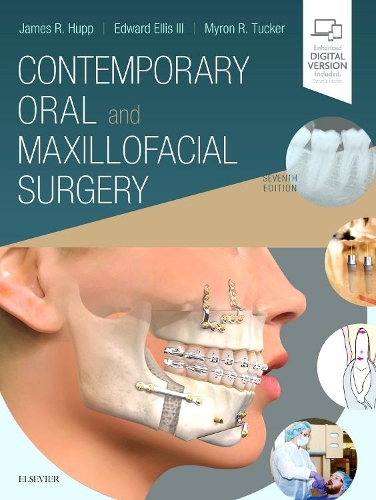 Паперова книга «Contemporary Oral and Maxillofacial Surgery», авторів Едвард Елліс, Джеймс Р. Хупп, Майрон Р. Такер - фото №1