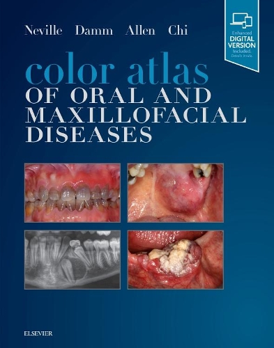 Бумажная книга «Color Atlas of Oral and Maxillofacial Diseases», авторов Анджела К. Чи, Брэд В. Невилл, Карл М. Аллен, Дуглас Д. Дамм - фото №1