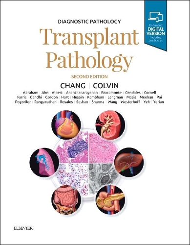 Бумажная книга «Diagnostic Pathology: Transplant Pathology», авторов Энтони К. Чанг, Мэтью Р. Линдберг - фото №1