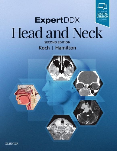 Бумажная книга «ExpertDDX: Head and Neck», авторов Бернадетт Л. Кох, Бронвин Э. Гамильтон - фото №1