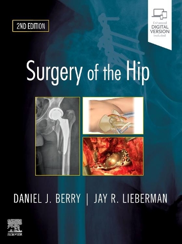 Паперова книга «Surgery of the Hip», авторів Деніел Дж. Беррі, Джей Ліберман - фото №1