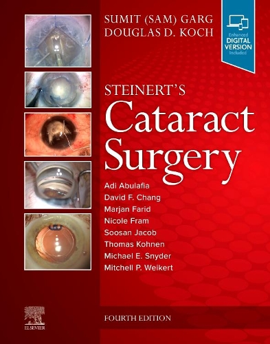 Бумажная книга «Steinert's Cataract Surgery», авторов Дуглас Д. Кох, Сумит Гарг - фото №1