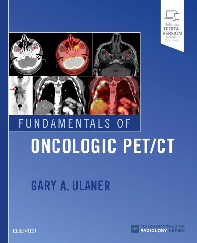Паперова книга «Fundamentals of Oncologic PET/CT», автор Гері А. Уланер - фото №1