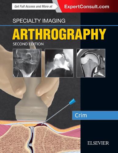 Паперова книга «Specialty Imaging: Arthrography», автор Джулія Р. Крім - фото №1