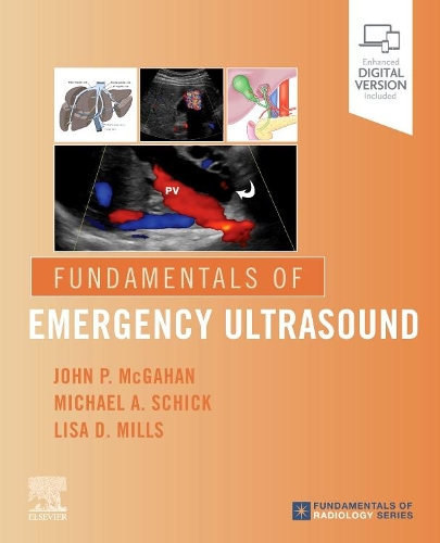 Паперова книга «Fundamentals of Emergency Ultrasound», авторів Джон П. МакГаган, Ліза Міллс, Майкл А. Шик - фото №1