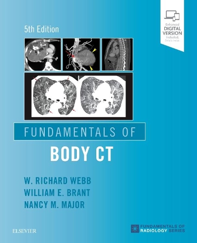Паперова книга «Fundamentals of Body CT», авторів Ненсі М. Мейджор, В. Річард Вебб, Вільям Е. Брант - фото №1