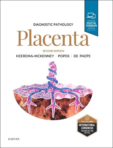 Паперова книга «Diagnostic Pathology: Placenta», авторів Емі Хірема-МакКенні, Едвіна Дж. Попек, Моніка Е. Де Паепе - фото №1
